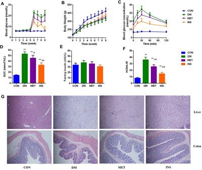 Comparative Evaluation of the Effect of Metformin and Insulin on Gut Microbiota and Metabolome Profiles of Type 2 Diabetic Rats Induced by the Combination of Streptozotocin and High-Fat Diet